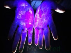 Резидентная микрофлора кожи рук